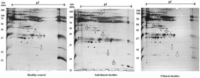 Alpha-2-Macroglobulin as a New Promising Biomarker Improving the Diagnostic Sensitivity of Bovine Paratuberculosis